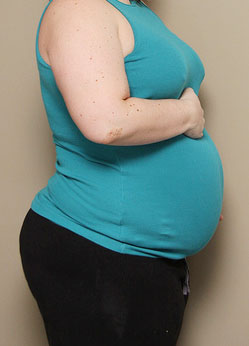 overweight and pregnant